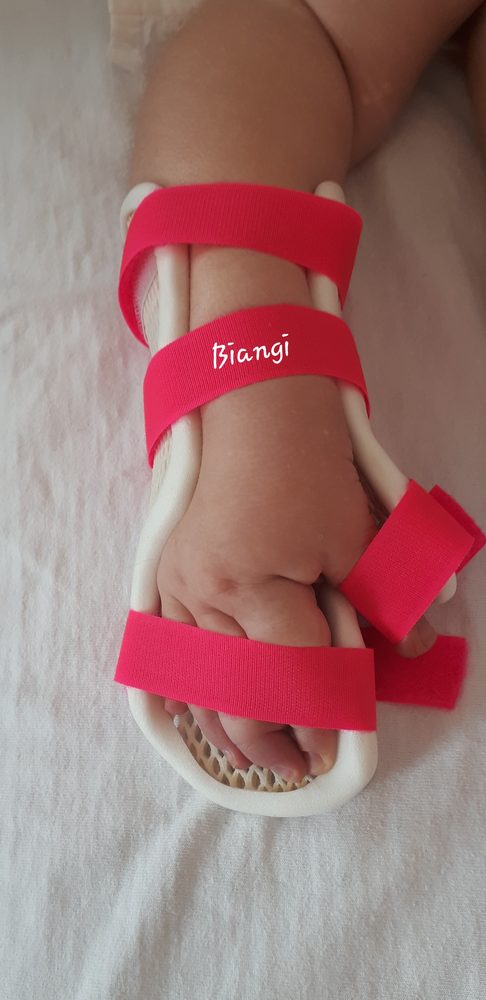 Orteze de mana